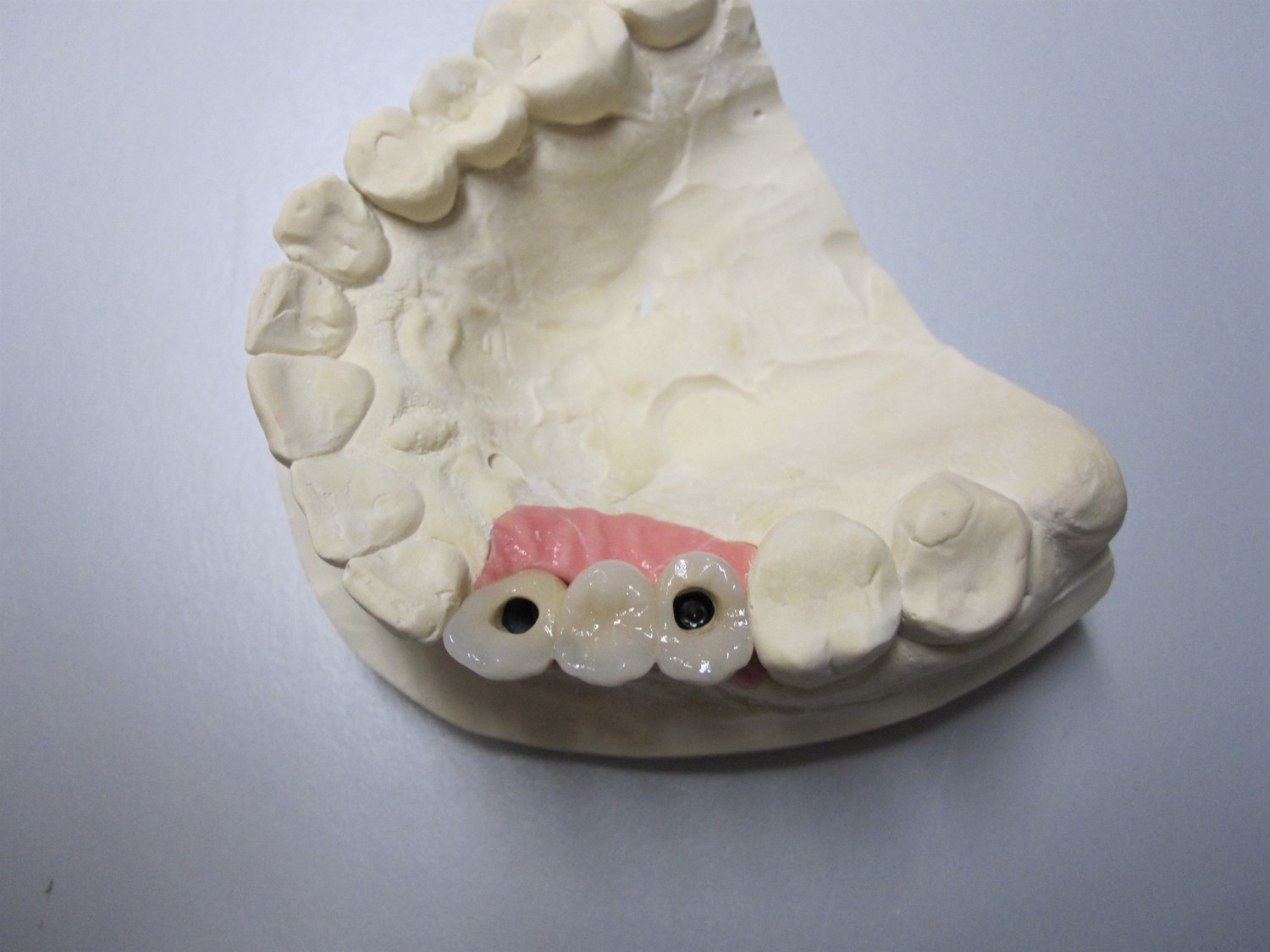 Implantater i Ringsted nær København